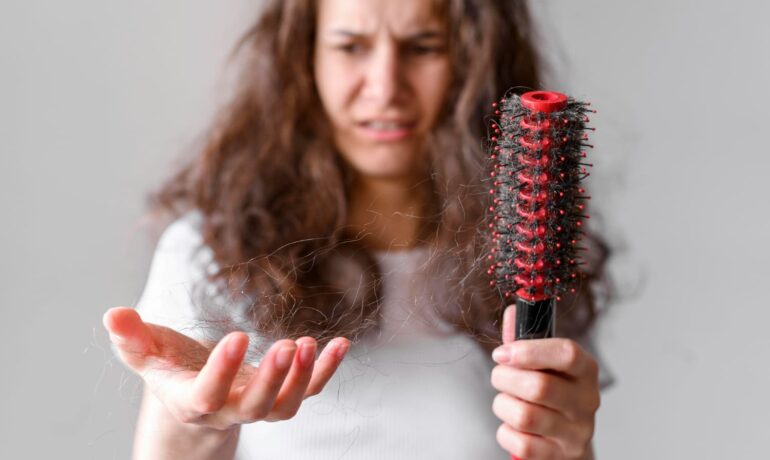alopecia nerviosa y caida pelo por estres